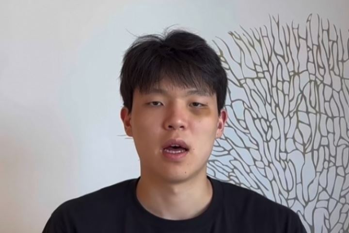 😲杨瀚森肿着熊猫眼回应东契奇：谢谢关注 等你的手机号 赛场见